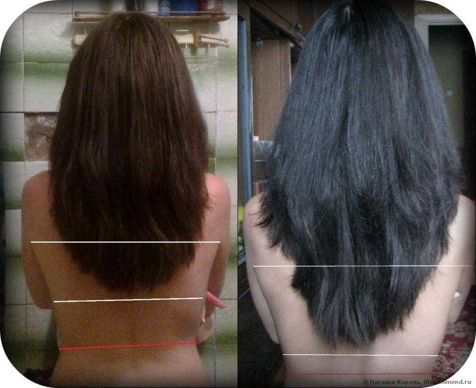 И быстро растет после. Волосы до после. Димексид для роста волос. Выросли волосы до и после. Маска для волос до и после.