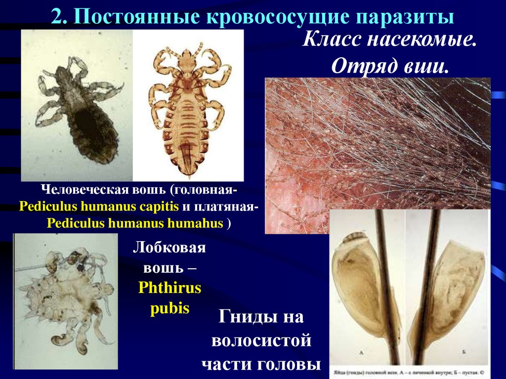 Лобковые вши латынь. Вивиды вшей. Головная платяная и лобковая вошь.