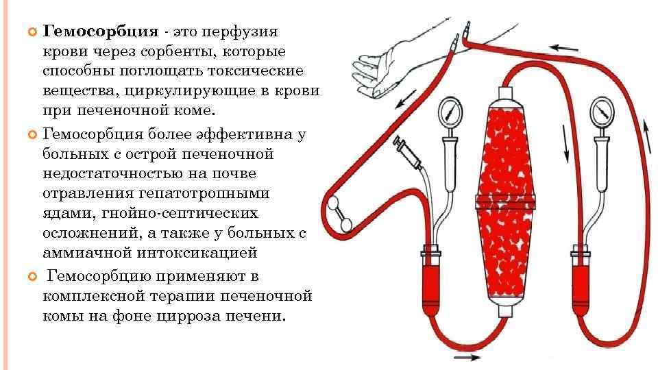 Схема аутогемотерапии при гнойных заболеваниях