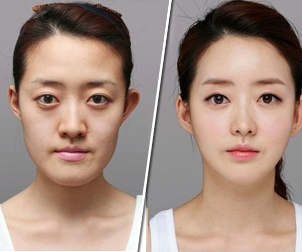 Изменение формы глаза. Второе веко у корейцев. Пластическая операция по изменению формы глаз. Люди с двойным веком. Одинарное веко у корейцев.