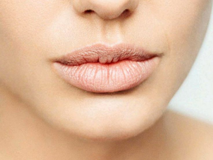 Формы нижней губы. Формы губ. Круглая форма губ. Красивая форма губ.