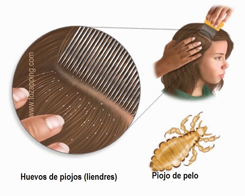 Как керосином вывести вшей у ребенка с длинными волосами в домашних условиях
