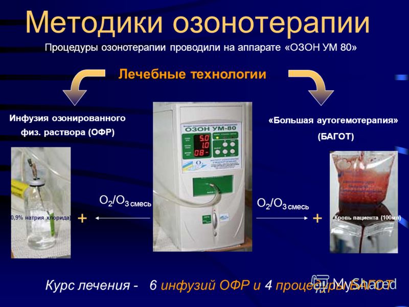 Аутогемотерапия. Аутогемотерапия методика проведения. Методики озонотерапии. Методика проведения озонотерапии. Аутогемотерапия показания схема.