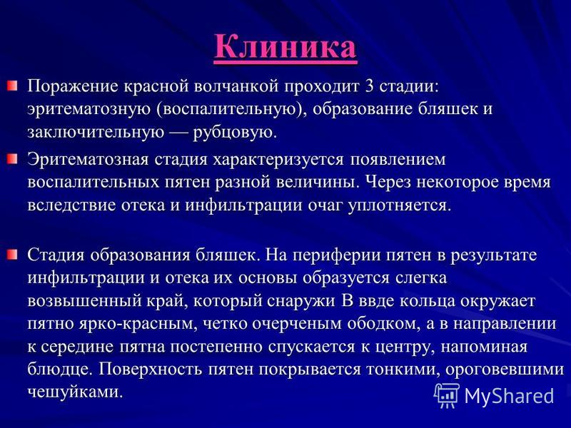 Кпл схема лечения