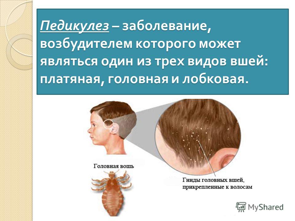 Педикулез рекомендации. Профилактика педикулеза. Педикулеза заболевания.