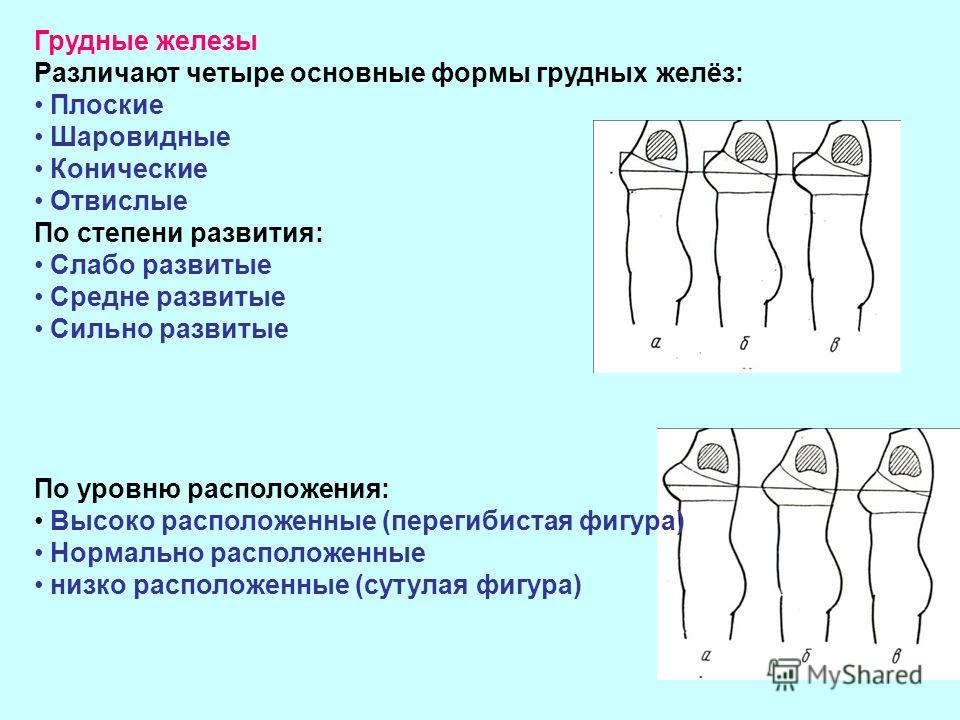 Форма молочных желез