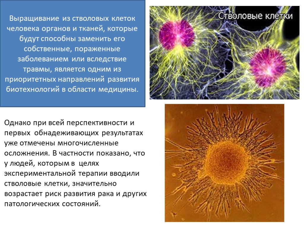 Стволовые клетки проект