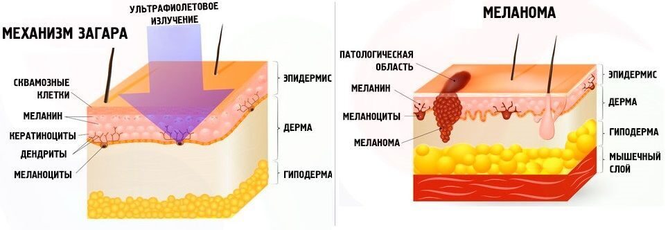 Загар образуется при. Меланин схема кожи. Меланин в эпидермисе. Меланин защищает от УФ-лучей. Защита от УФ лучей кожа.