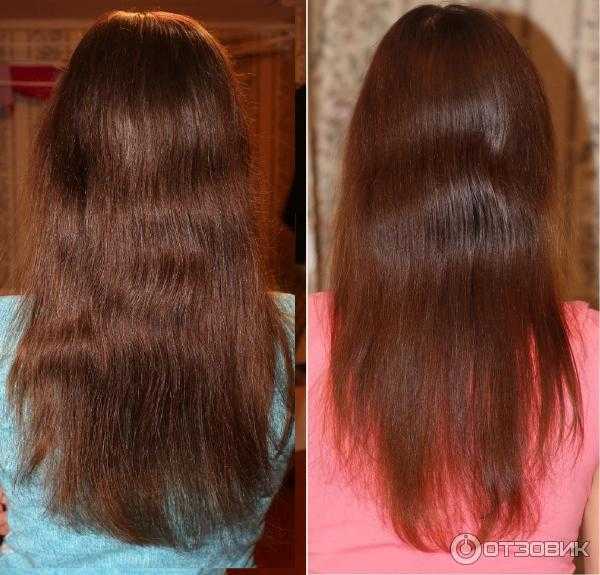 Восстановление густоты волос отзывы