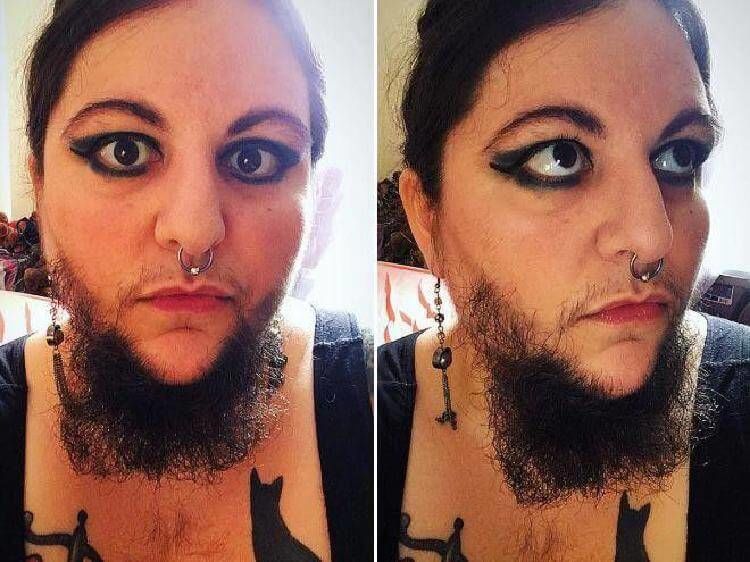 Теток бреют. Бородатая баба. Женская борода. Женщина с усами и бородой. Девушка с бородой.