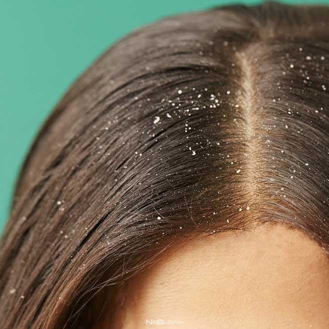 Как от песка могут выпасть волосы