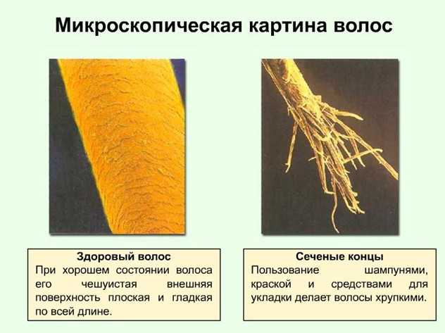 Волос под. Структура поврежденного волоса. Структура здорового волоса. Строение поврежденного волоса. Типы поврежденных волос.