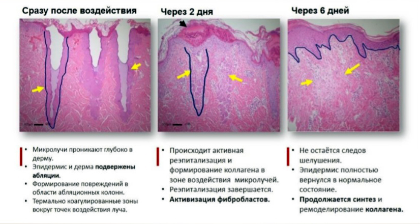 Фото Рубцов На Коже