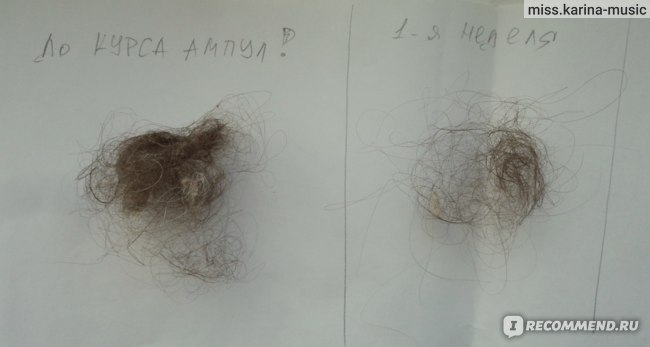 Выпадение волос при мытье. Норма выпадения волос. Норма выпадения волос в день. Норма выпадения волос при мытье. Норма выпадения волос в день у женщин.