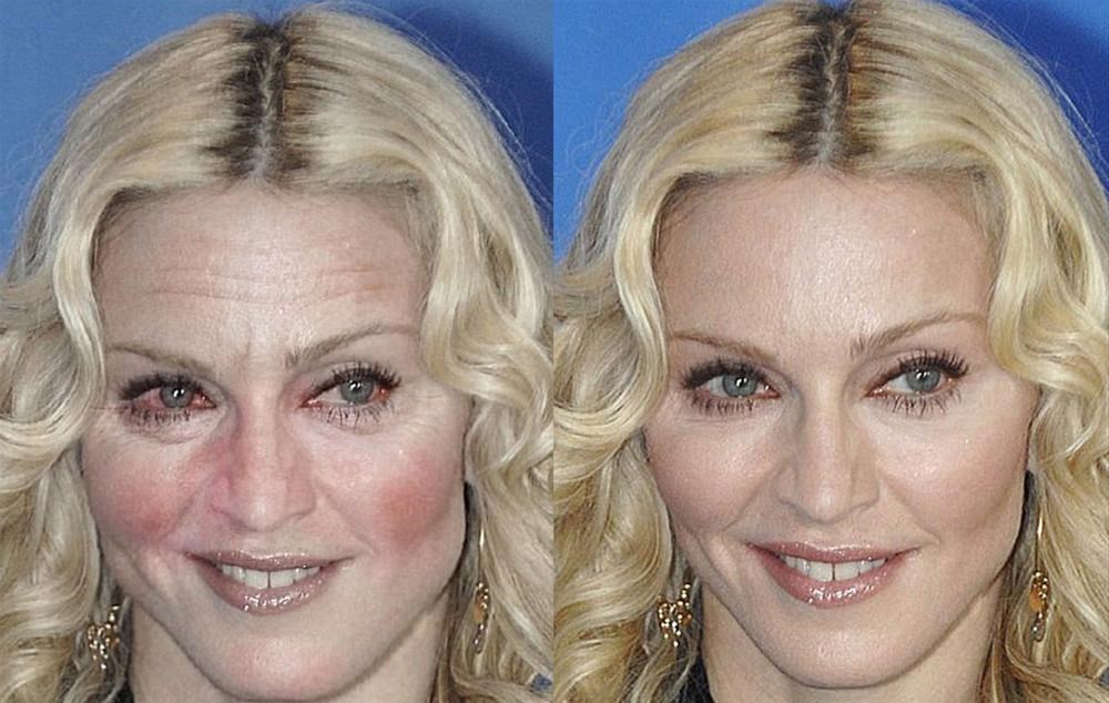 Признаки пьющей женщины. Мадонна лицо. Лица пьющих женщин знаменитостей. Алкогольное лицо женщины. Спившиеся знаменитости женщины до и после.