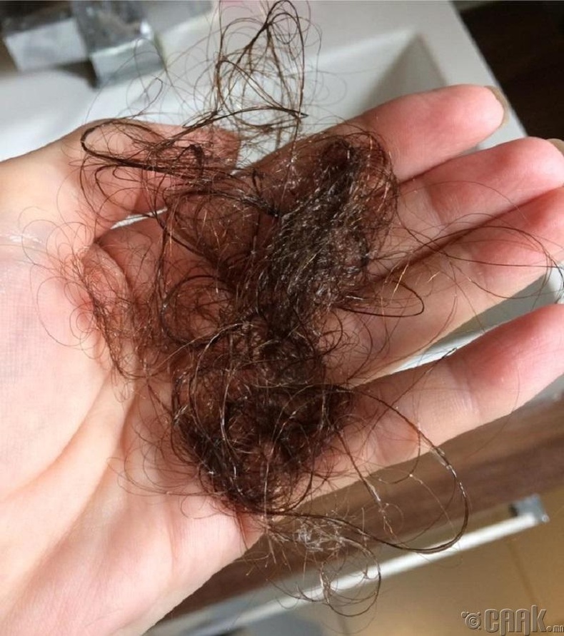 Почему выпадают волосы после мытья. Норма выпадения волос. Норма выпадения волос на голове.