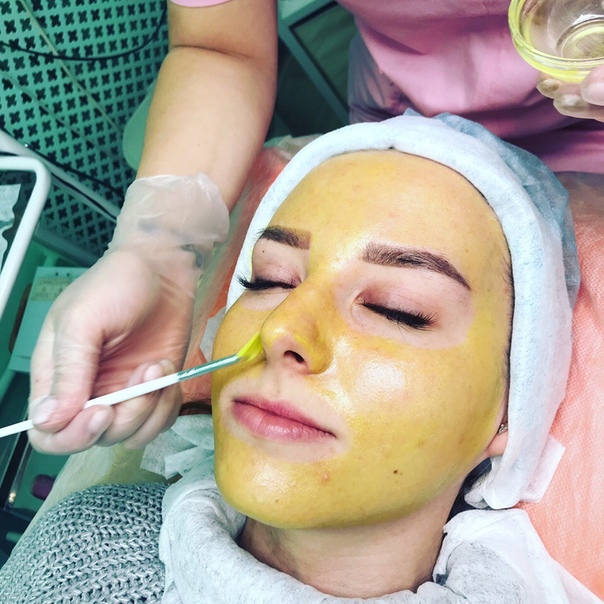 Желтый пилинг отзывы. Жёлтый пилинг Block age Peel Gel. Ретиноевый пилинг Мартинекс. MEDICCONTROLPEEL пилинг химический Block age Peel Gel. Химический пилинг желтый (ретиноевый) Block age Peel Gel.