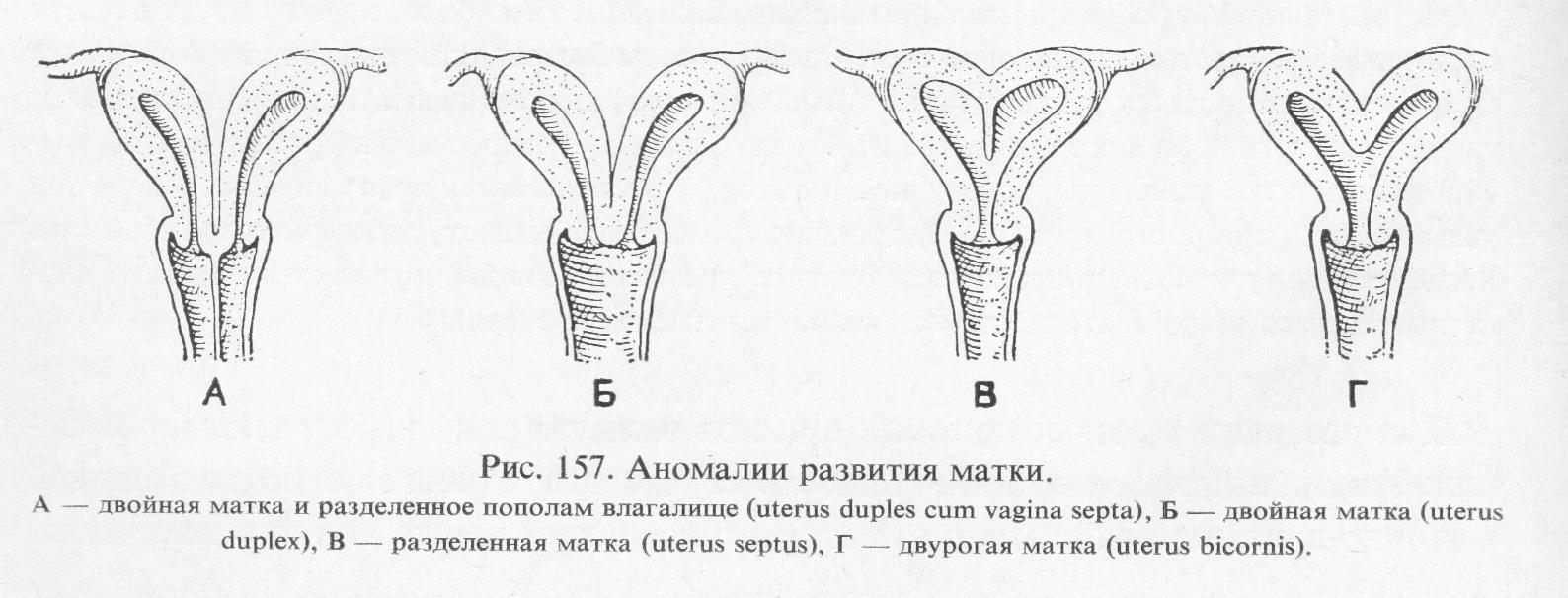 Аномалии Влагалища Фото