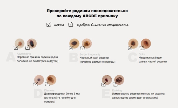 Красные родинки на теле причины появления у женщин фото